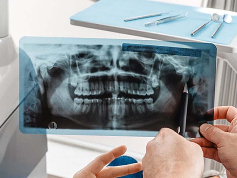 Röntgenbild gemacht in der Zahnarztpraxis Lopez